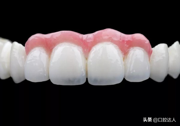 牙齿掉了有3种方式可以修补，你适合哪一种？
